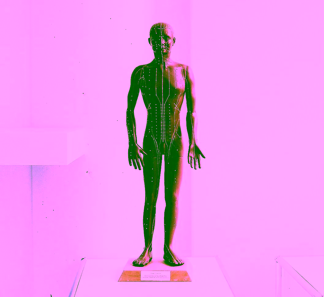 Darstellung der Akupunkturpunkte an einer Statue, Symbolbild für die Schmerztherapie mit Akupunktur