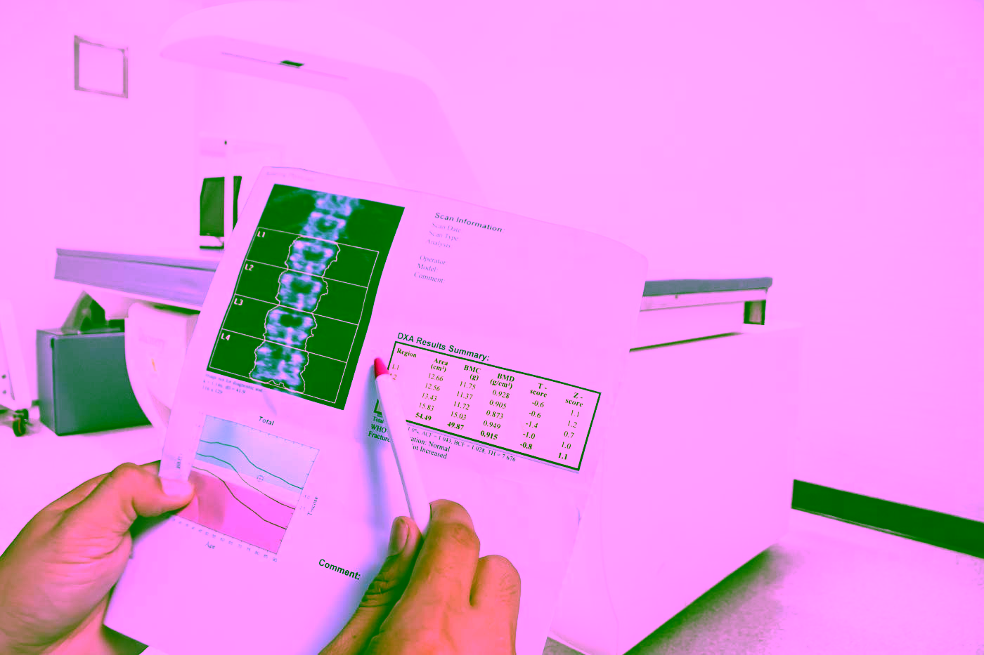 DXA-Knochendichtemessung - Ergebnisse auf einem Blatt vor dem Messgerät