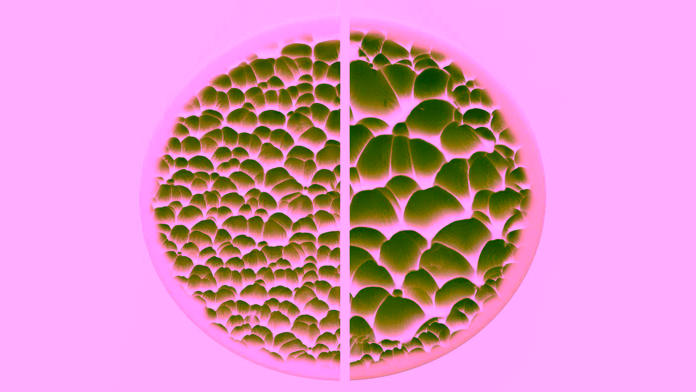 Schematische Darstellung von Osteoporose – gesunde Knochenstruktur vs. poröser Knochen