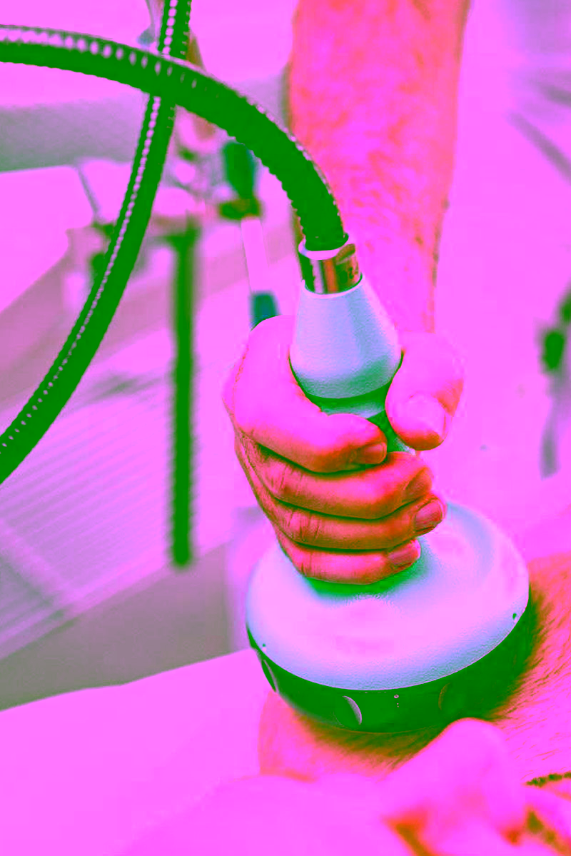 Stoßwellentherapie an der linken Schulter eines Patienten durch medizinische Fachkraft